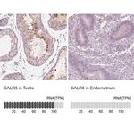 Calreticulin 3 Antibody