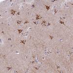 FAM3C Antibody in Immunohistochemistry (Paraffin) (IHC (P))