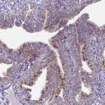 FAM3C Antibody in Immunohistochemistry (Paraffin) (IHC (P))