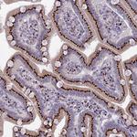 FAM3C Antibody in Immunohistochemistry (Paraffin) (IHC (P))