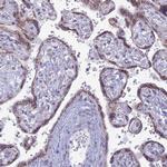 FAM3C Antibody in Immunohistochemistry (Paraffin) (IHC (P))