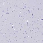 CD5 Antibody in Immunohistochemistry (Paraffin) (IHC (P))