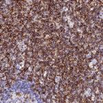 CD5 Antibody in Immunohistochemistry (Paraffin) (IHC (P))