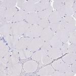 CD5 Antibody in Immunohistochemistry (Paraffin) (IHC (P))