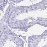 CD5 Antibody in Immunohistochemistry (Paraffin) (IHC (P))