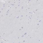 Uromodulin Antibody in Immunohistochemistry (Paraffin) (IHC (P))
