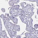 Uromodulin Antibody in Immunohistochemistry (Paraffin) (IHC (P))