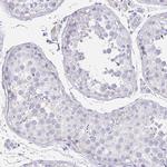 Uromodulin Antibody in Immunohistochemistry (Paraffin) (IHC (P))
