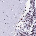 NSA2 Polyclonal Antibody