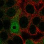 AP5S1 Polyclonal Antibody