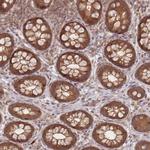 GLE1 Polyclonal Antibody