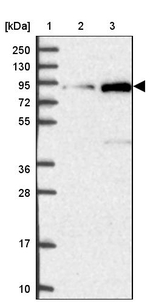 GLE1 Antibody in Western Blot (WB)