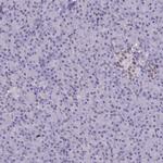 SAE1 Polyclonal Antibody