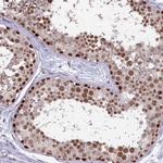 SAE1 Antibody in Immunohistochemistry (Paraffin) (IHC (P))