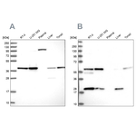 SAE1 Antibody in Western Blot (WB)