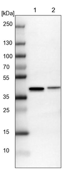 SAE1 Antibody in Western Blot (WB)