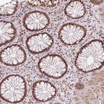 U2AF2 Polyclonal Antibody