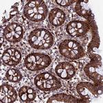 GALK2 Antibody in Immunohistochemistry (Paraffin) (IHC (P))