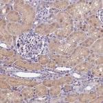 GALK2 Antibody in Immunohistochemistry (Paraffin) (IHC (P))