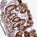 GALK2 Polyclonal Antibody