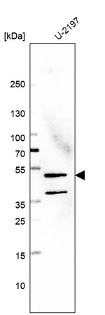 GALK2 Antibody in Western Blot (WB)