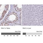 RALY Antibody