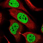 RALY Antibody in Immunocytochemistry (ICC/IF)