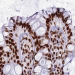 RALY Antibody in Immunohistochemistry (Paraffin) (IHC (P))