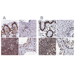 RALY Antibody in Immunohistochemistry (Paraffin) (IHC (P))
