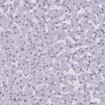 RALY Antibody in Immunohistochemistry (Paraffin) (IHC (P))