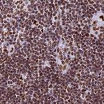 RALY Antibody in Immunohistochemistry (Paraffin) (IHC (P))
