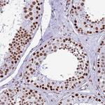 RALY Antibody in Immunohistochemistry (Paraffin) (IHC (P))