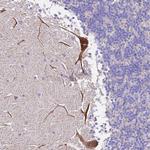 MRPL3 Antibody in Immunohistochemistry (Paraffin) (IHC (P))