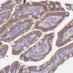 MRPL3 Antibody in Immunohistochemistry (Paraffin) (IHC (P))