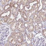 MRPL3 Antibody in Immunohistochemistry (Paraffin) (IHC (P))