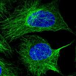 TUBA1A Polyclonal Antibody