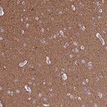 TUBA1A Antibody in Immunohistochemistry (Paraffin) (IHC (P))