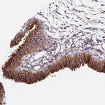 TUBA1A Antibody in Immunohistochemistry (Paraffin) (IHC (P))