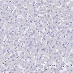 TUBA1A Antibody in Immunohistochemistry (Paraffin) (IHC (P))