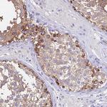 TUBA1A Antibody in Immunohistochemistry (Paraffin) (IHC (P))