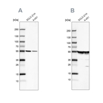 TUBA1A Antibody in Western Blot (WB)