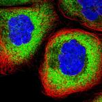 RPL17 Polyclonal Antibody