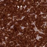 RPL17 Antibody in Immunohistochemistry (Paraffin) (IHC (P))