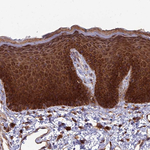 RPL17 Antibody in Immunohistochemistry (Paraffin) (IHC (P))