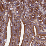RPL17 Antibody in Immunohistochemistry (Paraffin) (IHC (P))
