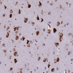 RPL17 Antibody in Immunohistochemistry (Paraffin) (IHC (P))