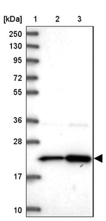 RPL17 Antibody in Western Blot (WB)