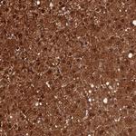 CRTC3 Antibody in Immunohistochemistry (Paraffin) (IHC (P))