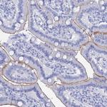 CD203c Antibody in Immunohistochemistry (Paraffin) (IHC (P))