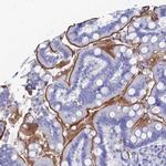 CD203c Polyclonal Antibody